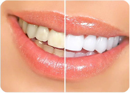 Cosmetic Dentistry